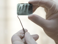 What to Expect When Having Periodontal Surgery