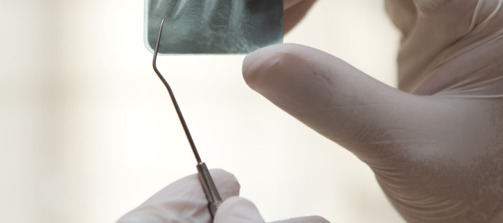 What to Expect When Having Periodontal Surgery